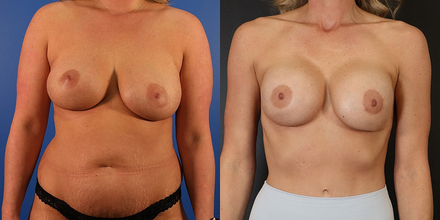 Before and after body transformation images.
