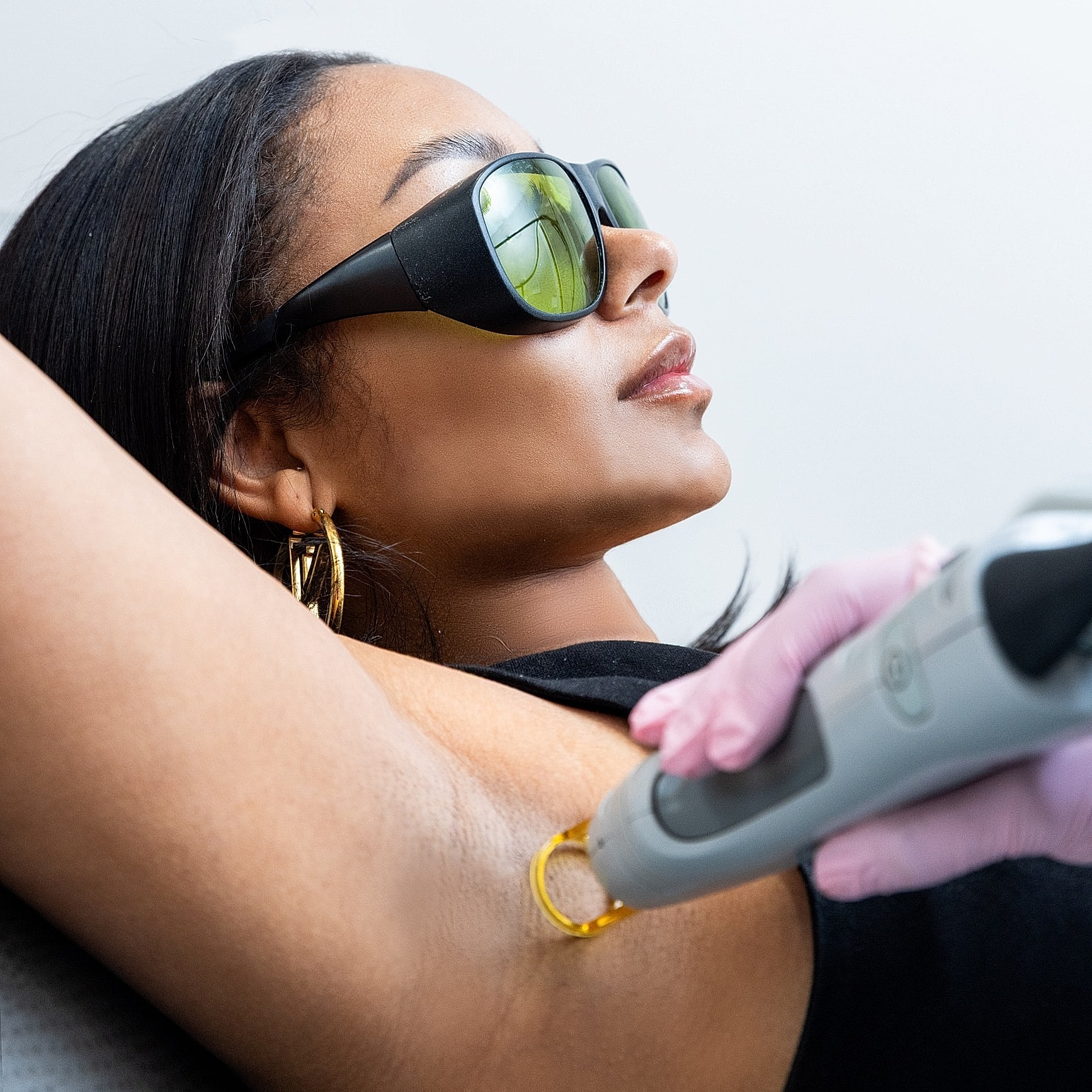 Woman undergoing laser hair removal treatment.